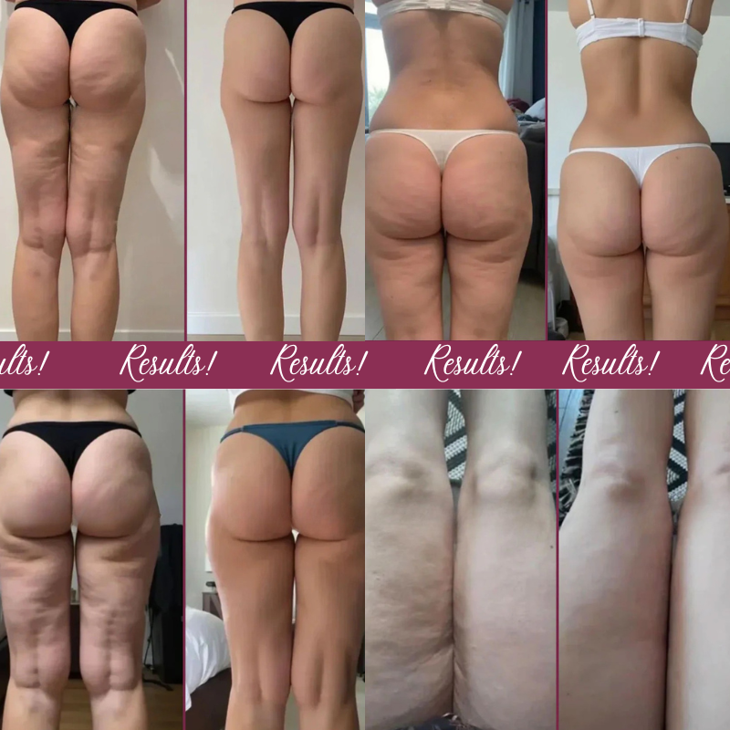 Leggings 3D Anti-cellulite