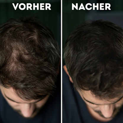 Veronni - Ansatzpuder