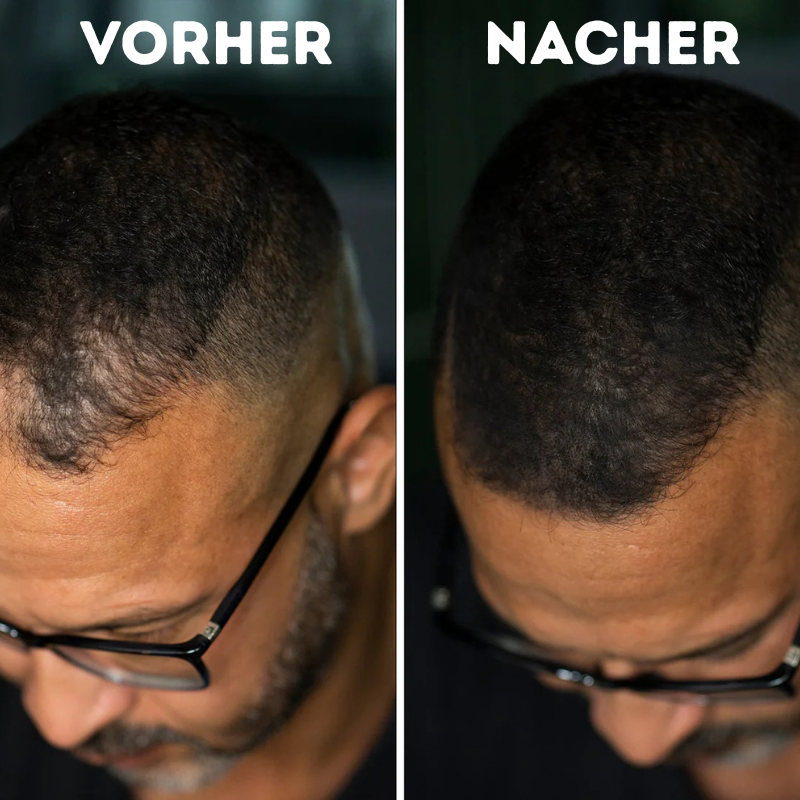 Veronni - Ansatzpuder